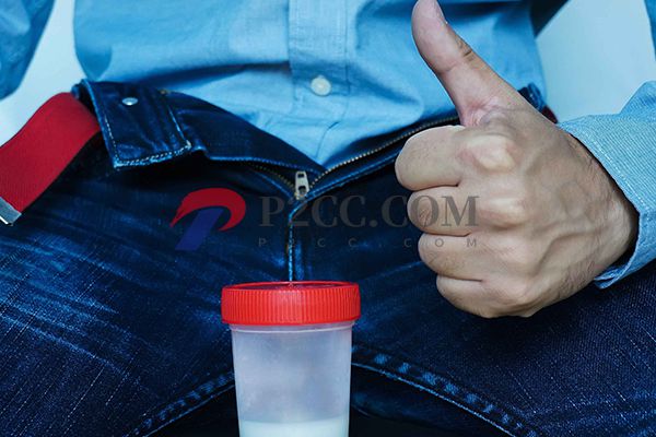 正常精子顏色為乳白色