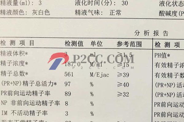 男性正常精子顏色對(duì)照表