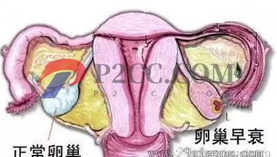 女人做了試管嬰兒人就廢了？好可怕，真的嗎？(圖2)