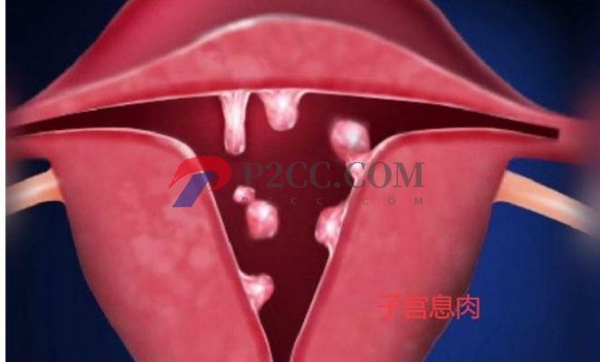 排卵期性腹痛和出血是怎么回事，需不需要治療？(圖2)