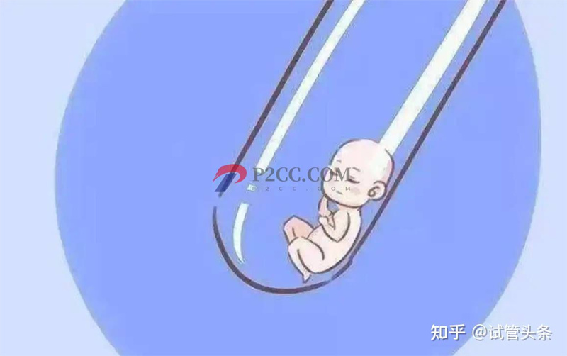 一代、二代、三代試管有什么不同(圖2)