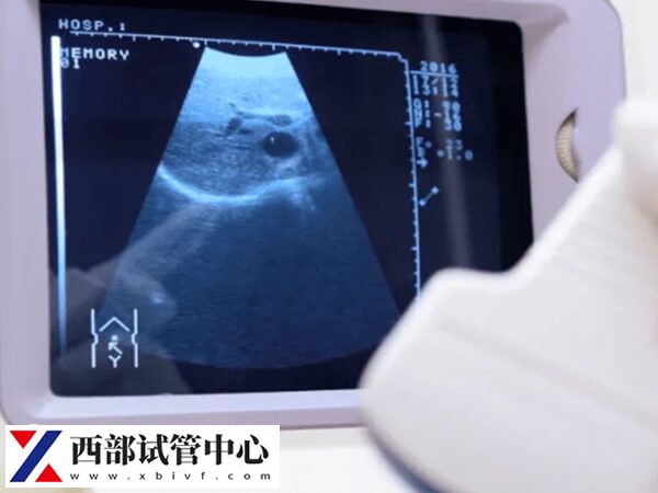 云南省做試管哪里技術(shù)好