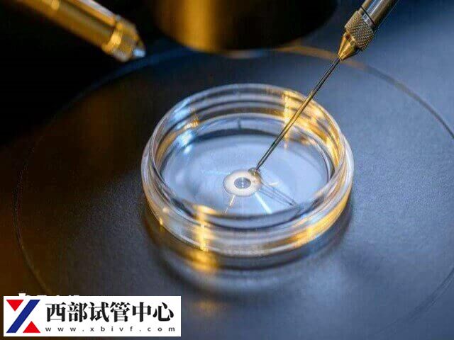 男性符合適應(yīng)癥是做供精試管的條件之一