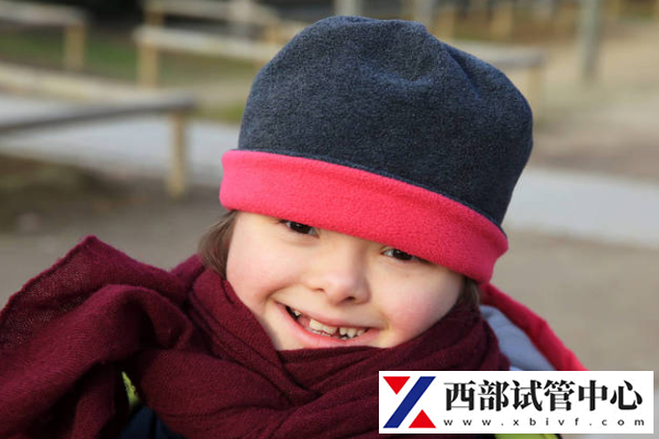 唐氏綜合癥風(fēng)險度如何看