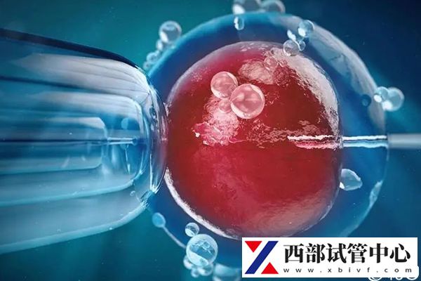 做人工授精可以去寧夏