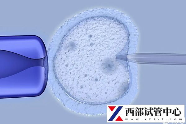 不同輔助生殖技術(shù)臨床妊娠率不一樣