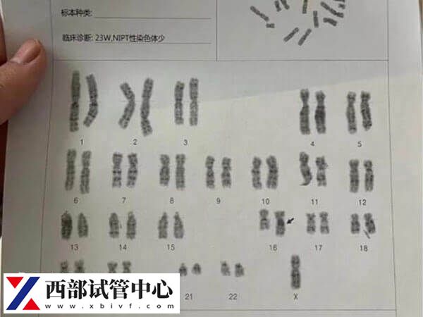 二代試管不可以篩查染色體