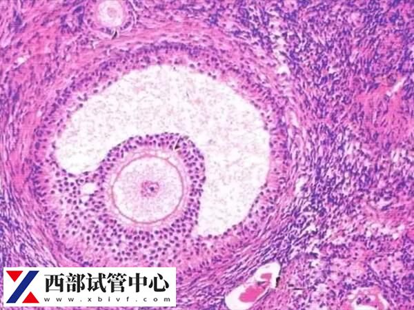 促排卵期間需要做b超檢查