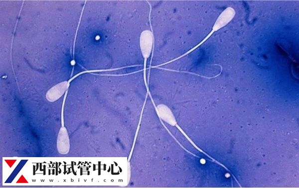 精子檢查最好去正規(guī)三甲醫(yī)院