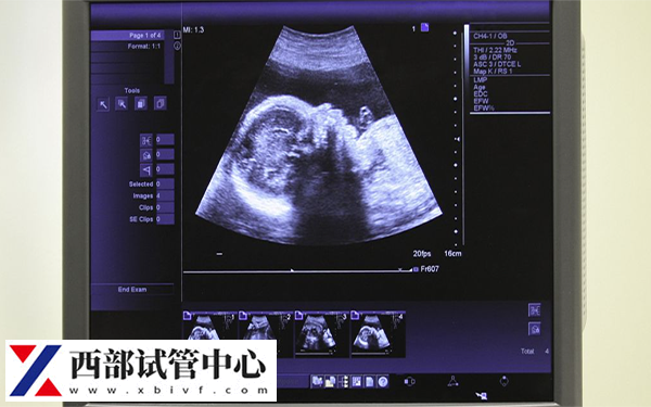 fsh10.8做試管成功率不高